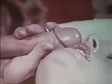 Sphincter Stretcher