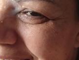 Mature Facial