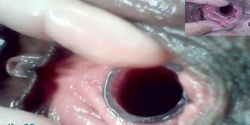 Lesbians Extreme Cervix Play and Peehole Fucking Penis Dildo